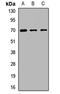 Zinc Finger MYND-Type Containing 11 antibody, orb412444, Biorbyt, Western Blot image 