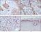 Keratin 17 antibody, MA5-15534, Invitrogen Antibodies, Immunohistochemistry paraffin image 