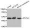 Dihydropyrimidinase Like 3 antibody, STJ23426, St John