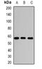 SGSH antibody, LS-B15545, Lifespan Biosciences, Western Blot image 