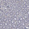 Plasminogen Activator, Urokinase Receptor antibody, HPA050843, Atlas Antibodies, Immunohistochemistry paraffin image 