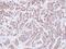 Peptidylprolyl Isomerase A antibody, GTX104698, GeneTex, Immunohistochemistry paraffin image 