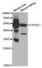 Cytochrome P450 Family 2 Subfamily E Member 1 antibody, LS-C331945, Lifespan Biosciences, Western Blot image 