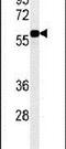 Dyskerin Pseudouridine Synthase 1 antibody, PA5-25393, Invitrogen Antibodies, Western Blot image 