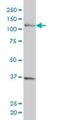 Chromosome Transmission Fidelity Factor 18 antibody, H00063922-M01, Novus Biologicals, Western Blot image 