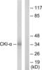 Casein Kinase 1 Alpha 1 antibody, LS-C118904, Lifespan Biosciences, Western Blot image 