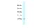 NADH:Ubiquinone Oxidoreductase Subunit A6 antibody, A08920, Boster Biological Technology, Western Blot image 