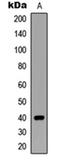 Siah E3 Ubiquitin Protein Ligase 2 antibody, orb304586, Biorbyt, Western Blot image 