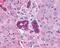 Vasoactive Intestinal Peptide Receptor 2 antibody, NLS1305, Novus Biologicals, Immunohistochemistry frozen image 