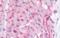 Caveolin 1 antibody, orb314062, Biorbyt, Immunohistochemistry paraffin image 