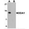 DET1 And DDB1 Associated 1 antibody, MBS151338, MyBioSource, Western Blot image 