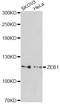Zinc Finger E-Box Binding Homeobox 1 antibody, STJ28276, St John