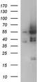 Ankyrin repeat and MYND domain-containing protein 2 antibody, TA507305, Origene, Western Blot image 