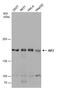 Inverted Formin, FH2 And WH2 Domain Containing antibody, PA5-78560, Invitrogen Antibodies, Western Blot image 