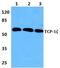 Chaperonin Containing TCP1 Subunit 6A antibody, GTX66745, GeneTex, Western Blot image 