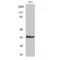 Interleukin-20 receptor subunit beta antibody, LS-C384103, Lifespan Biosciences, Western Blot image 