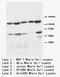 Apoptotic Peptidase Activating Factor 1 antibody, LS-C172086, Lifespan Biosciences, Western Blot image 