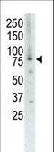 Muscle Associated Receptor Tyrosine Kinase antibody, LS-C99097, Lifespan Biosciences, Western Blot image 