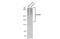 Glutamate Metabotropic Receptor 5 antibody, GTX132899, GeneTex, Western Blot image 