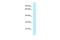 TBC1 Domain Family Member 20 antibody, A08733, Boster Biological Technology, Western Blot image 