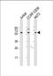 Chaperonin Containing TCP1 Subunit 8 Like 2 antibody, PA5-72299, Invitrogen Antibodies, Western Blot image 