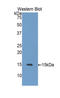 Heat Shock Protein Family H (Hsp110) Member 1 antibody, LS-C301137, Lifespan Biosciences, Western Blot image 