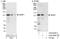 WW Domain Containing E3 Ubiquitin Protein Ligase 1 antibody, A302-949A, Bethyl Labs, Immunoprecipitation image 