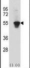 Ribosomal Oxygenase 2 antibody, PA5-11157, Invitrogen Antibodies, Western Blot image 