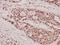 FES Proto-Oncogene, Tyrosine Kinase antibody, A01453-1, Boster Biological Technology, Immunohistochemistry paraffin image 