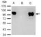 Nuclear Receptor Subfamily 3 Group C Member 1 antibody, GTX101120, GeneTex, Immunoprecipitation image 