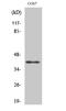 Alcohol Dehydrogenase 7 (Class IV), Mu Or Sigma Polypeptide antibody, STJ91499, St John