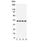C-X-C Motif Chemokine Receptor 1 antibody, R31191, NSJ Bioreagents, Western Blot image 