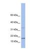 T Cell Leukemia/Lymphoma 1A antibody, NBP1-54693, Novus Biologicals, Western Blot image 