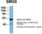 SMG8 Nonsense Mediated MRNA Decay Factor antibody, TA344922, Origene, Western Blot image 