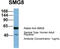 SMG8 Nonsense Mediated MRNA Decay Factor antibody, TA344922, Origene, Western Blot image 