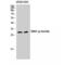 Snail Family Transcriptional Repressor 1 antibody, LS-C381168, Lifespan Biosciences, Western Blot image 