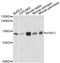 V-Set And Immunoglobulin Domain Containing 1 antibody, A12873, Boster Biological Technology, Western Blot image 