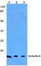 Cystatin A antibody, A03914-1, Boster Biological Technology, Western Blot image 