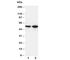 CD14 antibody, R30515, NSJ Bioreagents, Western Blot image 