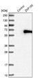 Zinc Finger Protein 155 antibody, NBP1-80912, Novus Biologicals, Western Blot image 