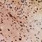 Ubiquitin Conjugating Enzyme E2 A antibody, LS-C668180, Lifespan Biosciences, Immunohistochemistry paraffin image 