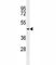 Transmembrane Serine Protease 11E antibody, F40096-0.4ML, NSJ Bioreagents, Western Blot image 