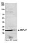 Mitochondrial Ribosomal Protein L17 antibody, NBP2-60701, Novus Biologicals, Western Blot image 