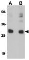 Coiled-coil domain-containing protein 106 antibody, GTX85167, GeneTex, Western Blot image 