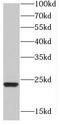 HD Domain Containing 2 antibody, FNab03806, FineTest, Western Blot image 