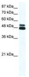 Cholinergic Receptor Nicotinic Beta 2 Subunit antibody, TA330426, Origene, Western Blot image 