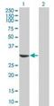 Microtubule Associated Protein RP/EB Family Member 1 antibody, PA1-41706, Invitrogen Antibodies, Western Blot image 
