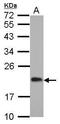 CGG Triplet Repeat Binding Protein 1 antibody, GTX115103, GeneTex, Western Blot image 