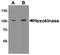 Hexokinase 1 antibody, A01504-2, Boster Biological Technology, Western Blot image 