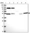 Coiled-Coil Domain Containing 8 antibody, PA5-59811, Invitrogen Antibodies, Western Blot image 